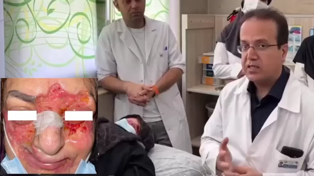 تزریق ماده غیراستاندارد توسط آرایشگر در صورت این بیمار