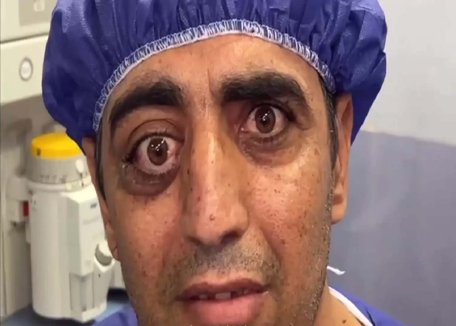 جراحی تومور حجیم غده اشکی