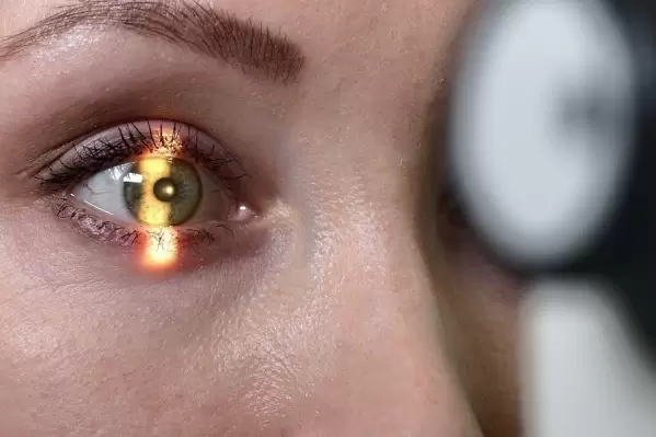 سرطان چشم چقدر شایع است؟