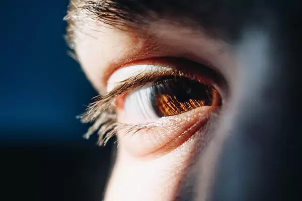 تومور گلیوم عصب بینایی ( تومور عصب چشم) چیست و چگونه درمان می‌شود؟