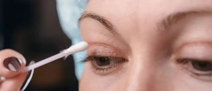 عوارض جراحی پلاستیک پلک